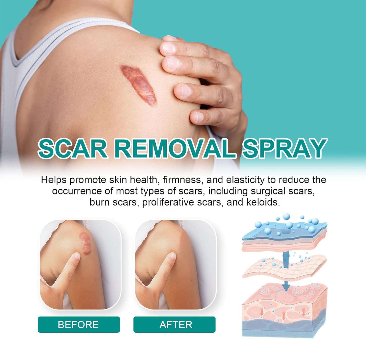 Scar Remove Medical Grade Scar Spray