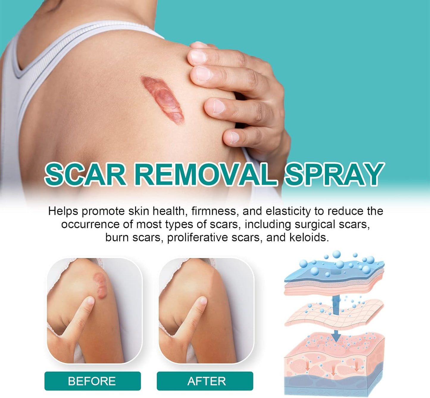 Scar Remove Medical Grade Scar Spray